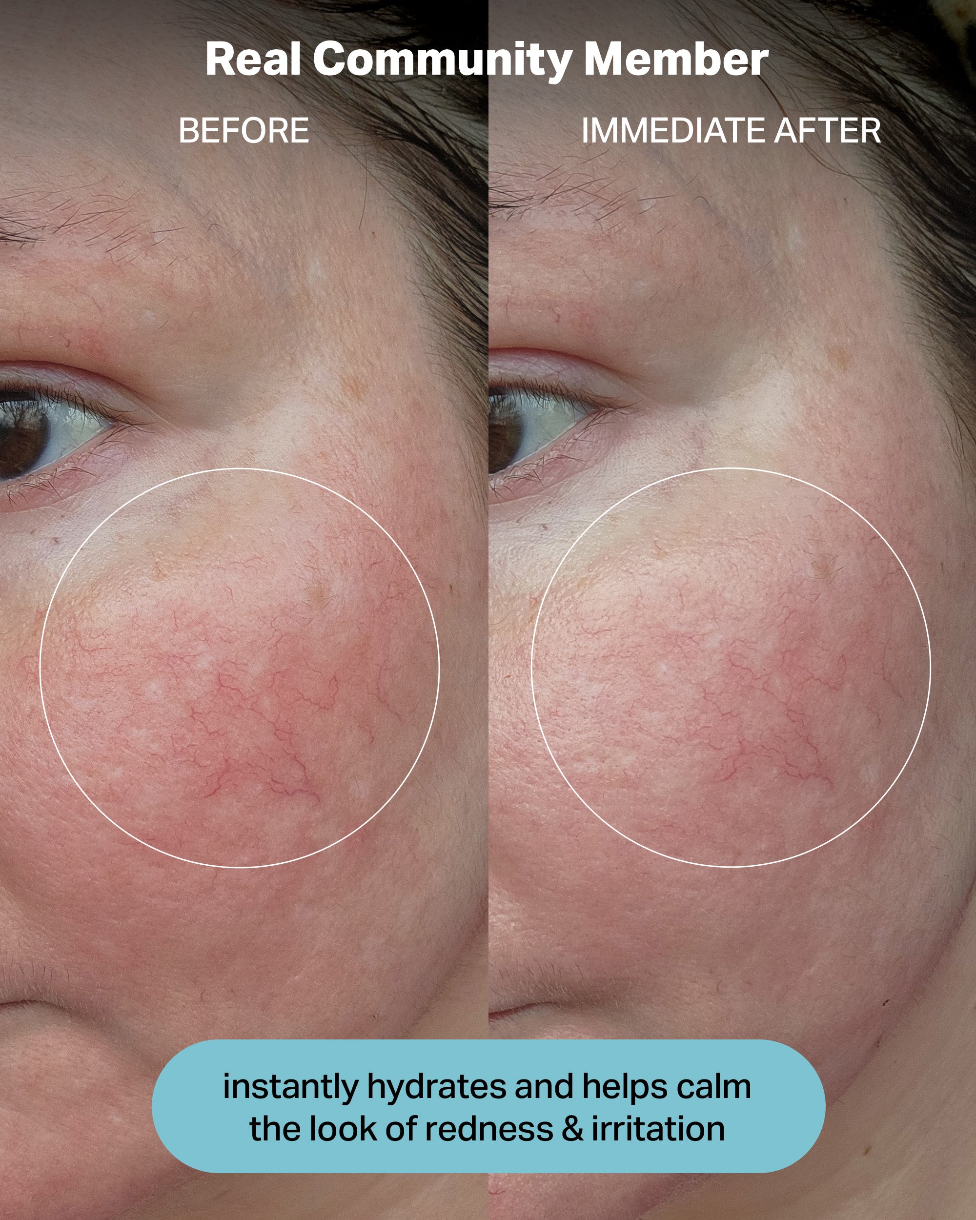 hydration electrolyte rescue serum - cocokind