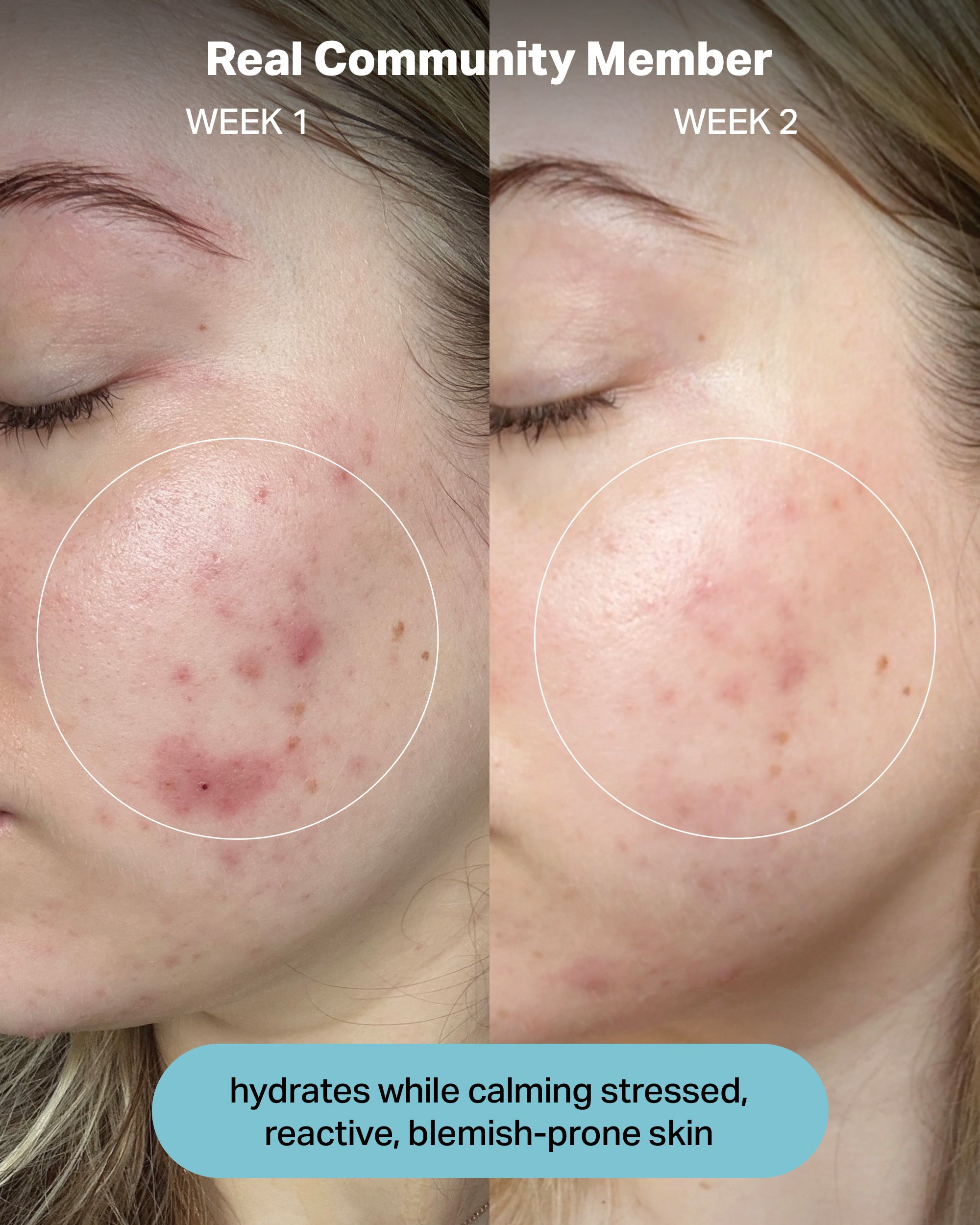 hydration electrolyte rescue serum - cocokind