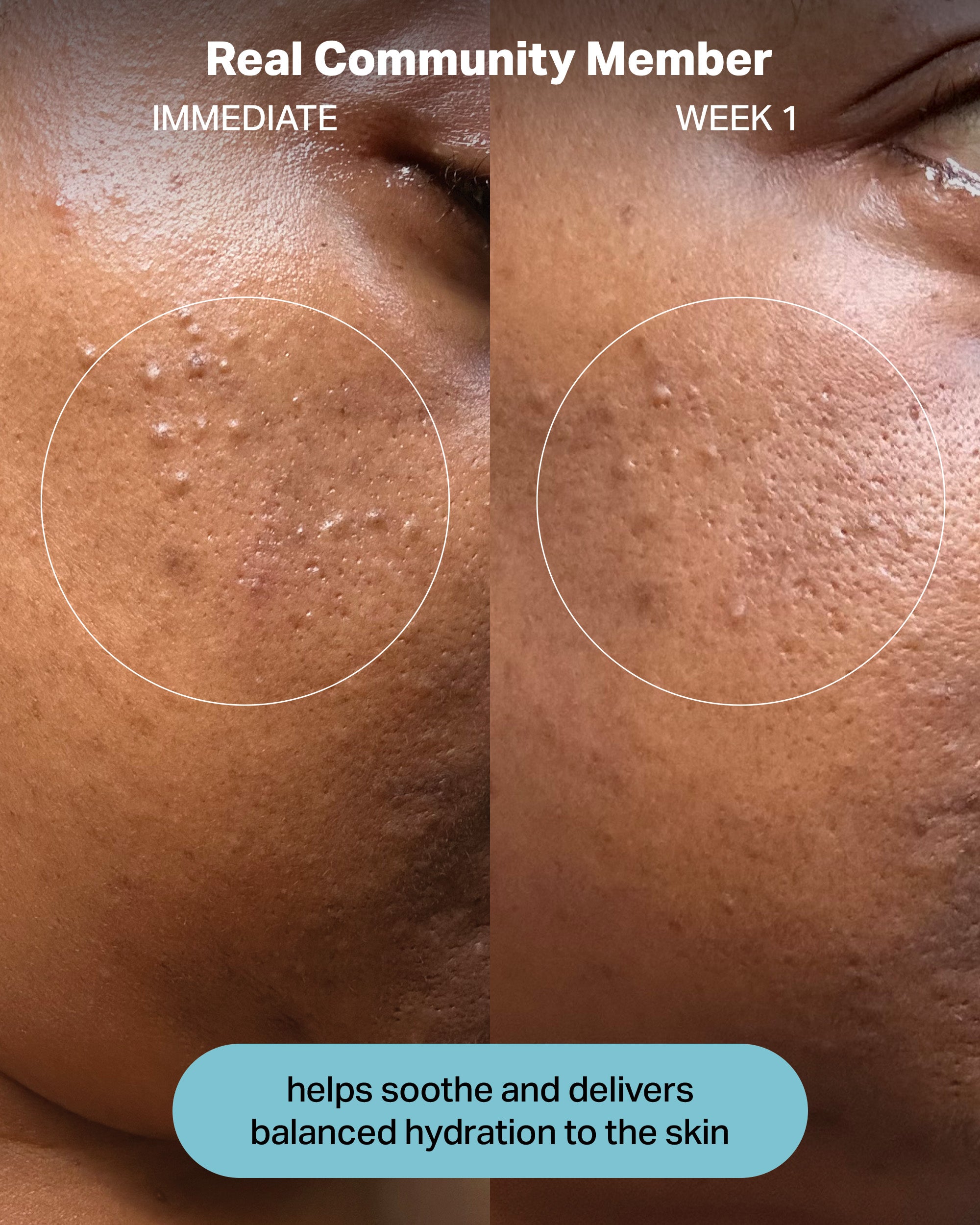 hydration electrolyte rescue serum - cocokind
