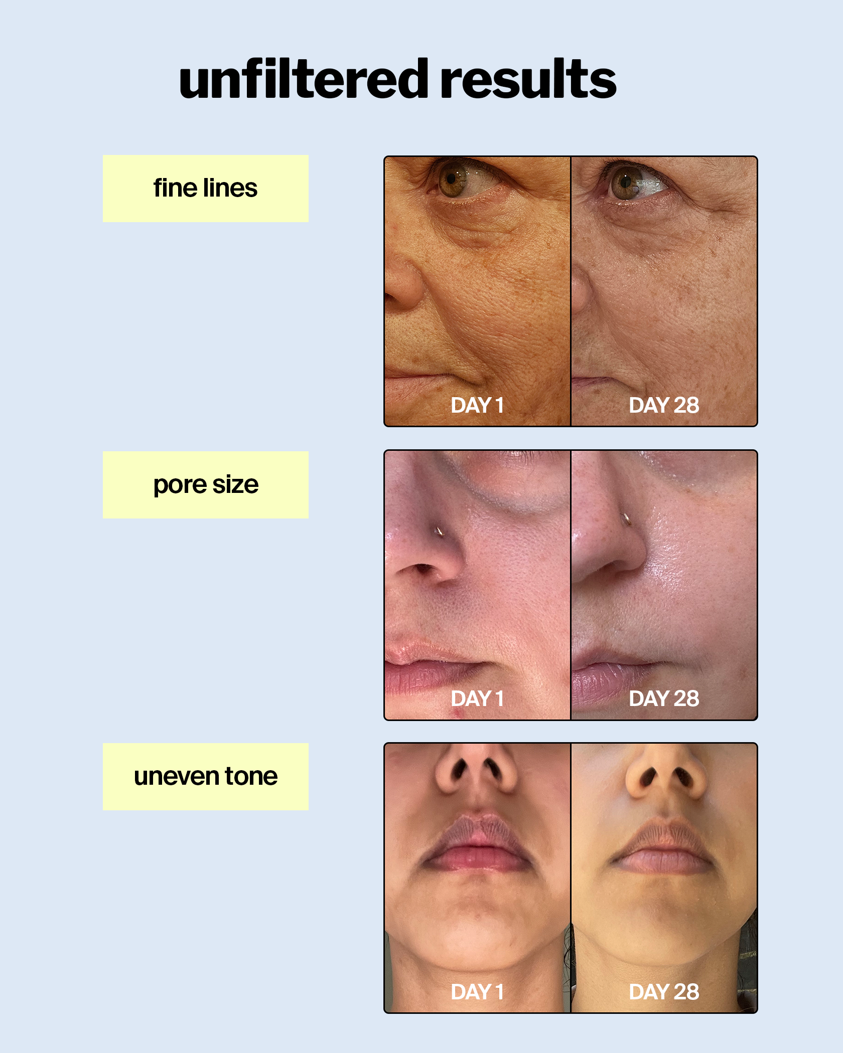 advanced retinol gel 0.5% - cocokind